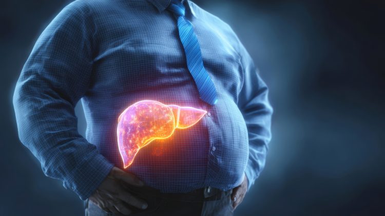 A Frequently Missed Liver Disease