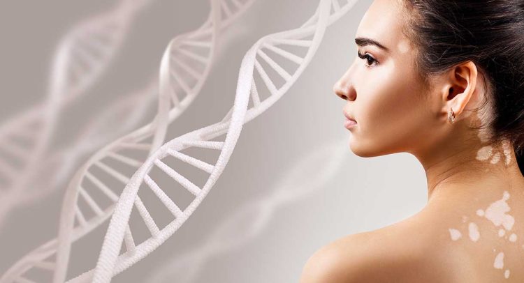 Autoimmune Conditions