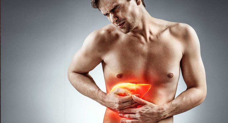 Cirrhosis