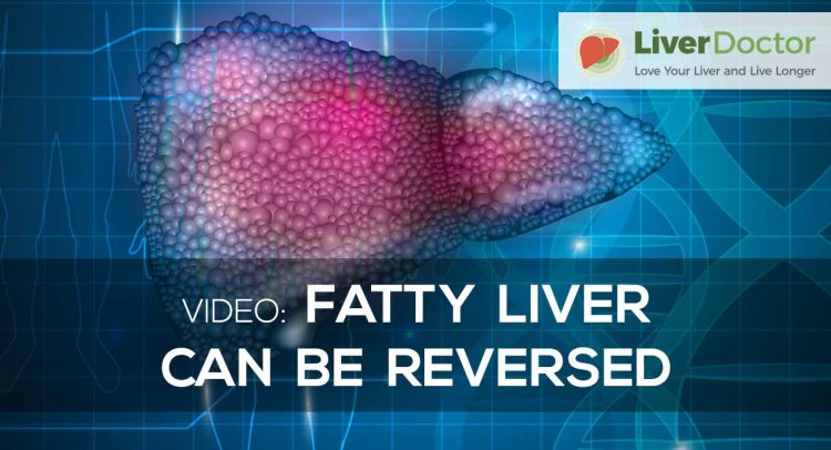 Video | Fatty Liver Can Be Reversed