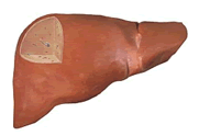 Liver-Doctor-Cirrhosis-Liver-Healthy-Liver