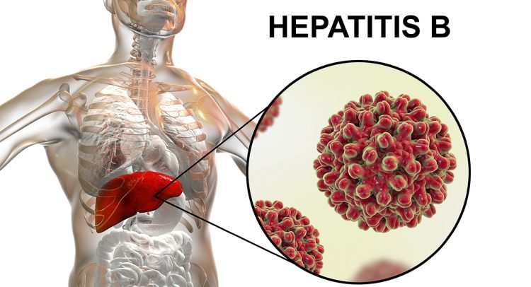 Hepatitis B