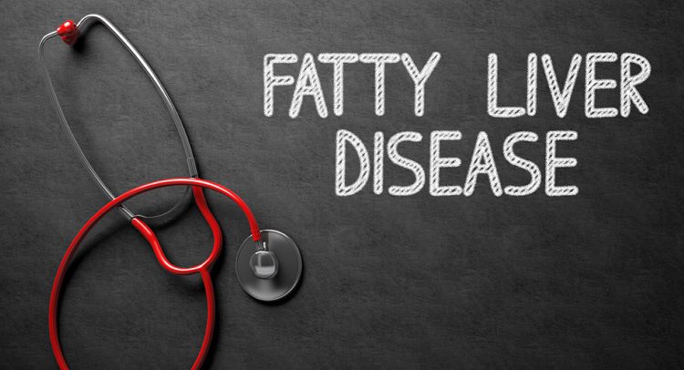 Having A Fatty Liver Does Not Mean You’re An Alcoholic