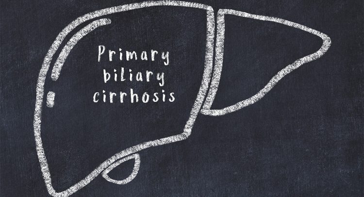Primary Biliary Cirrhosis – what you must know