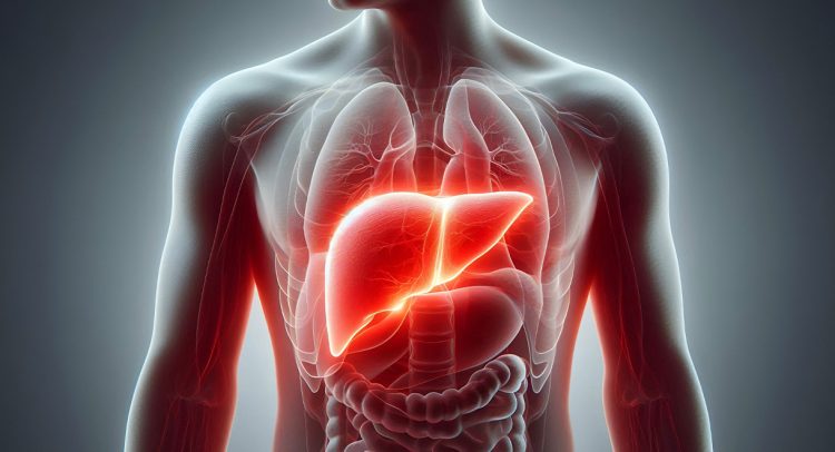 Systemic Inflammation Worsens Cirrhosis