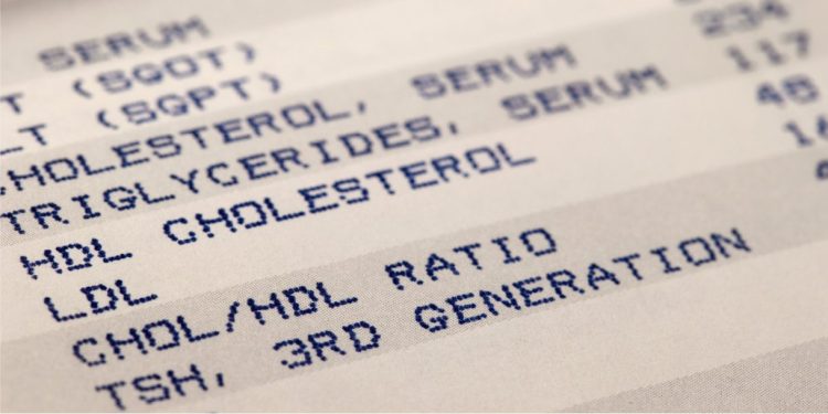 Cholesterol and the liver