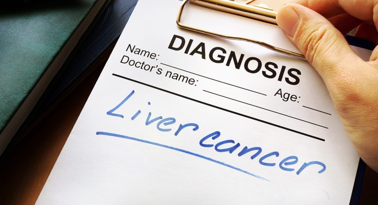 Liver Cancer Skyrocketing