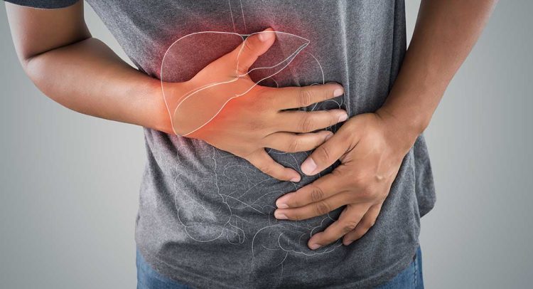 Hemochromatosis