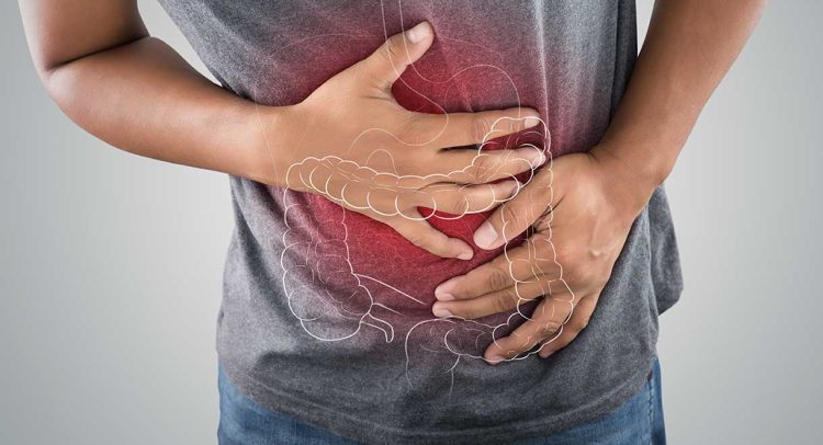 Irritable Bowel Syndrome