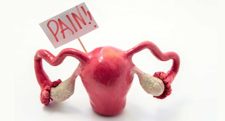 Polycystic Ovarian Syndrome