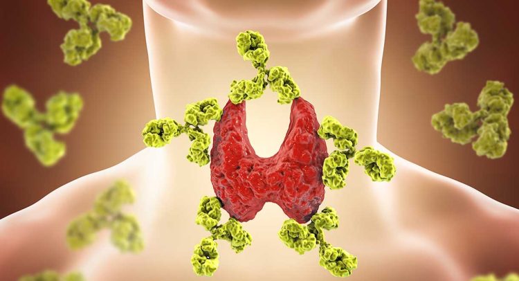 Thyroid Disease