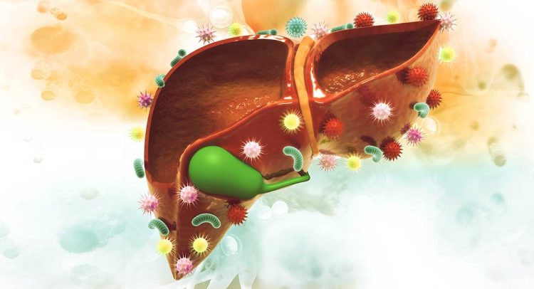 Polycystic Liver Disease (PLD)