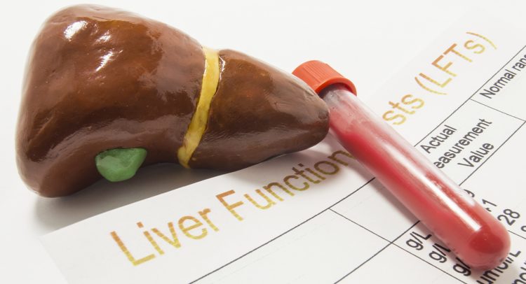 Thanks To You I Got An Almost Perfect Score On My Liver Function Test
