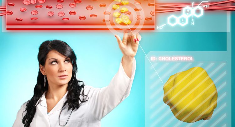Don’t Worry About Cholesterol; Inflammation Is Your Biggest Problem