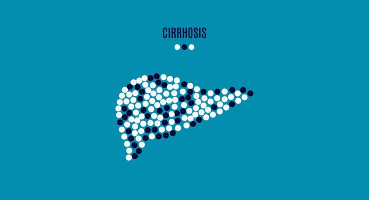 Cirrhosis Of The Liver