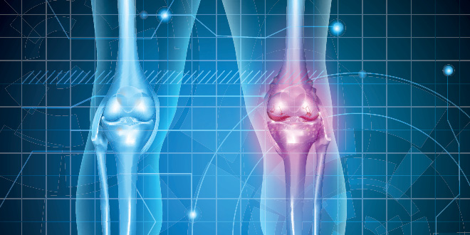 Knee Pain and Surgery