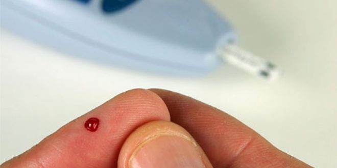 A common skin condition might indicate you have type 2 diabetes