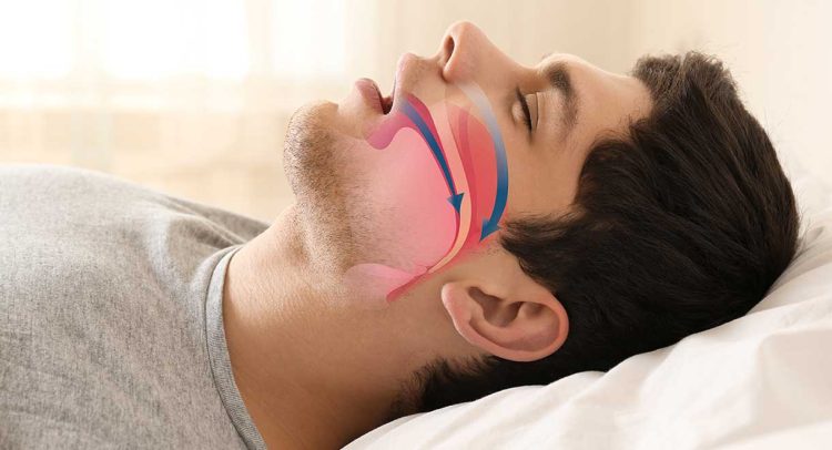 Sleep Apnea Raises The Risk Of Glaucoma