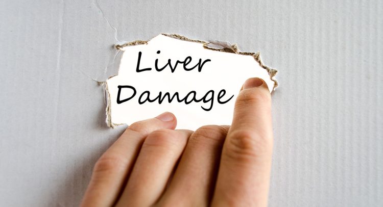 External Signs Of Liver Problems