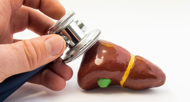 Gallbladder: Natural Treatments