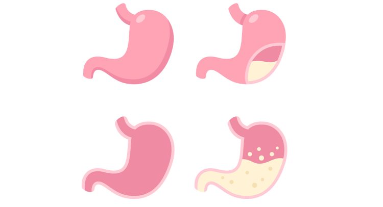 Do You Produce Enough Stomach Acid?