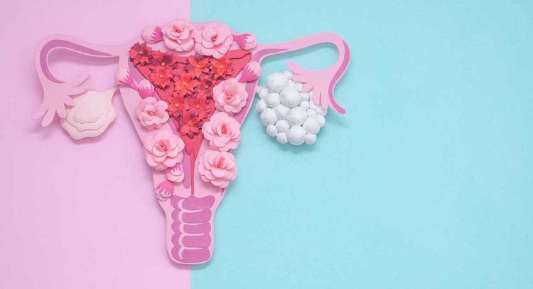 Polycystic Ovarian Syndrome May Be Caused By An Imbalance In Gut Bacteria
