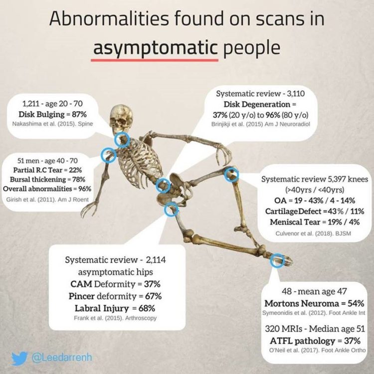 Did You Know Scans Don’t Always Match Symptoms?