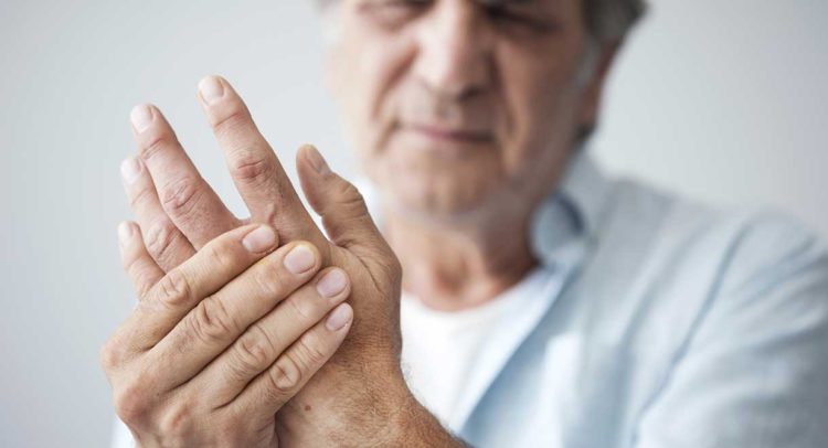 Case Study: Fatty Liver And Arthritis
