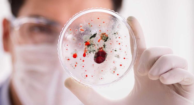 Viral Infections More Dangerous In Selenium Deficient People