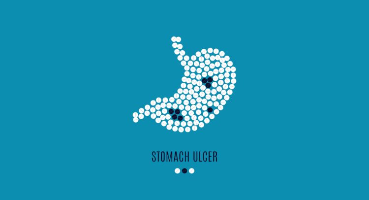 Natural Remedies For Stomach Ulcers