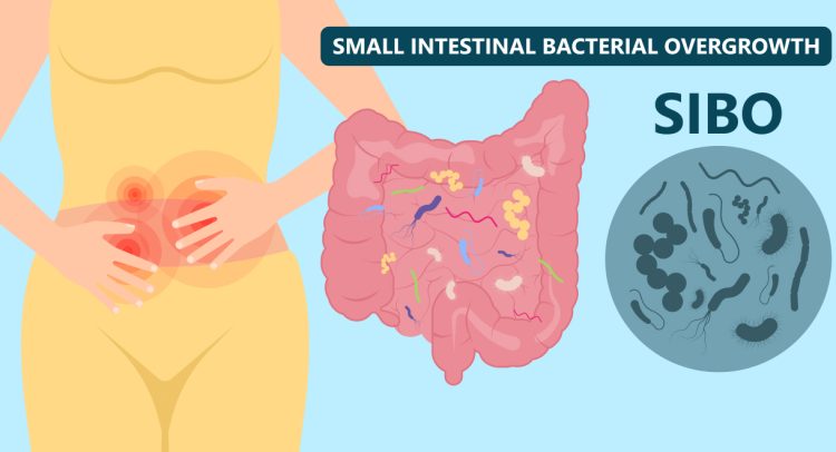 Is SIBO Causing Your Anxiety?