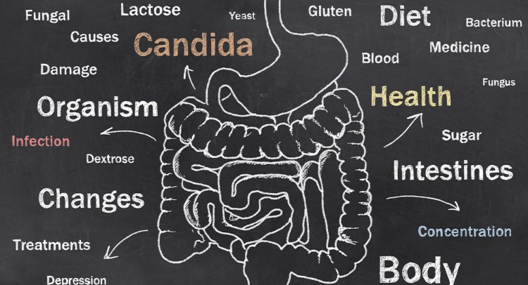 Could You Have A Candida Infection?