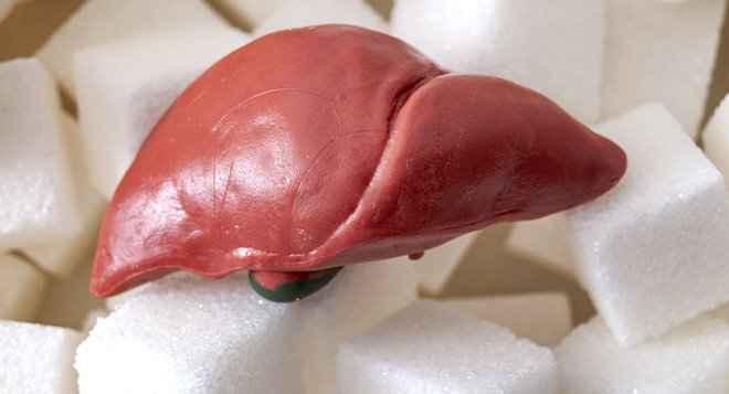 Sugar Could Be Silently Damaging Your Liver