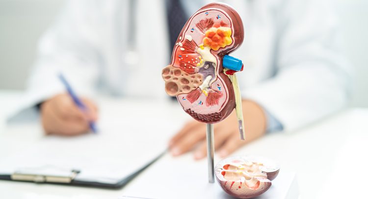 Diabetics Are At Higher Risk Of Kidney Problems