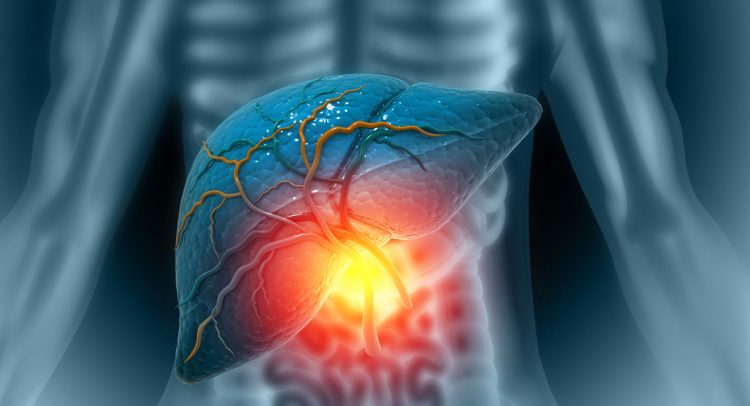 Why Do So Many People Have A Gallbladder Problem?