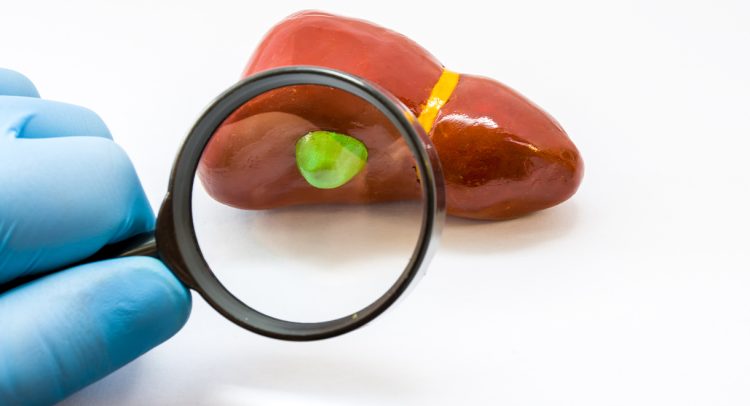Best Supplements After Gallbladder Removal