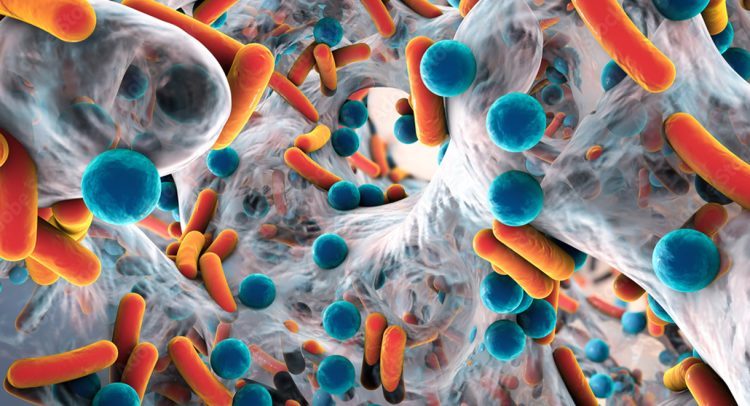 Biofilms And Chronic Infections