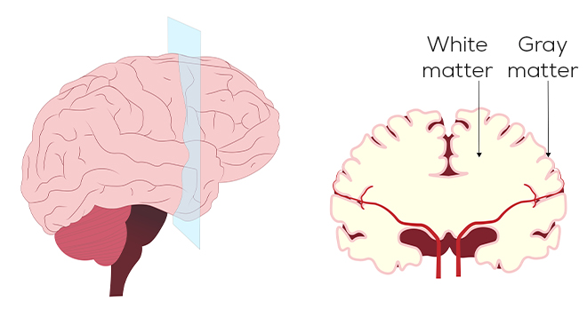 Brain white and gray matter
