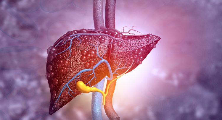 Liver Inflammation Can Damage Your Brain