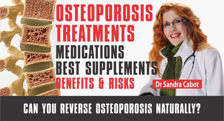 Video | Part 3 | Osteoporosis Treatment | Medication | Best Osteoporosis Supplements 