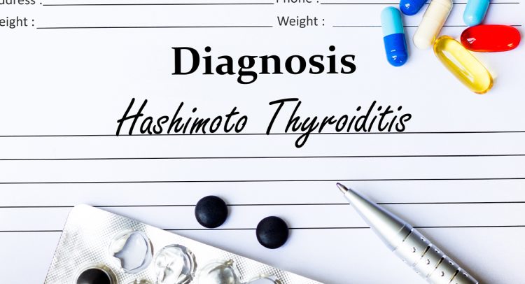 Case Study: Hashimoto’s Thyroiditis And Joint Pain