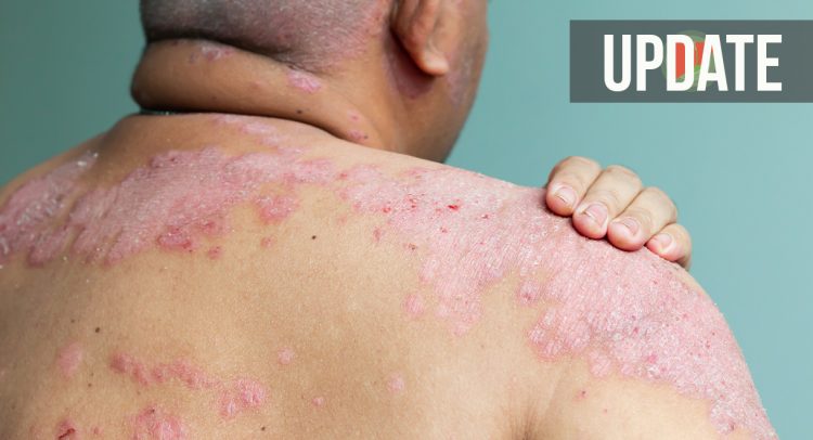 Case Study UPDATE: Psoriasis and a Fatty Liver