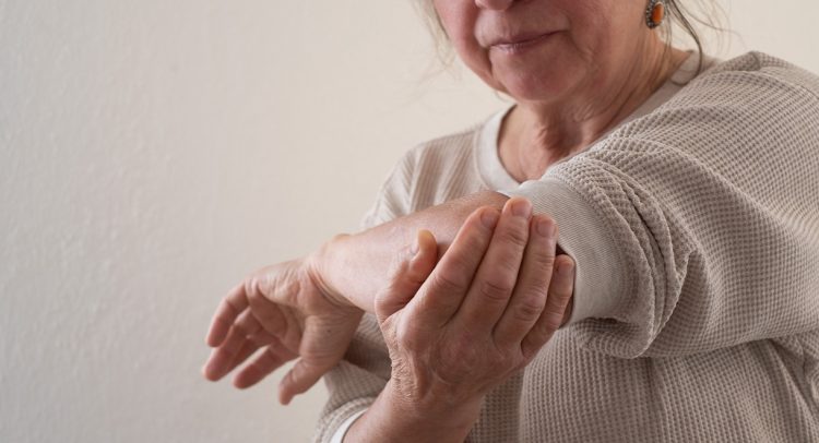 Why Muscle and Bone Weaken Together